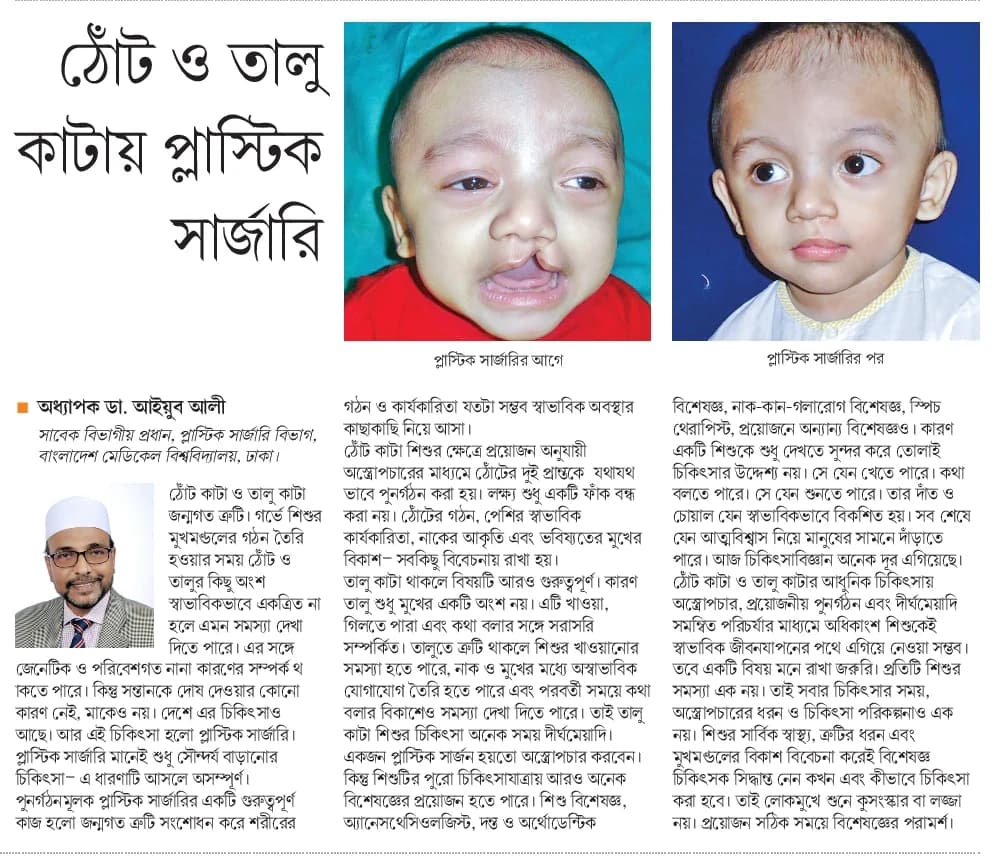 Newspaper clipping: “ঠোঁট ও তালু কাটায় প্লাস্টিক সার্জারি” by Prof. Dr. Ayub Ali, Desh Rupantor, 6 September 2026