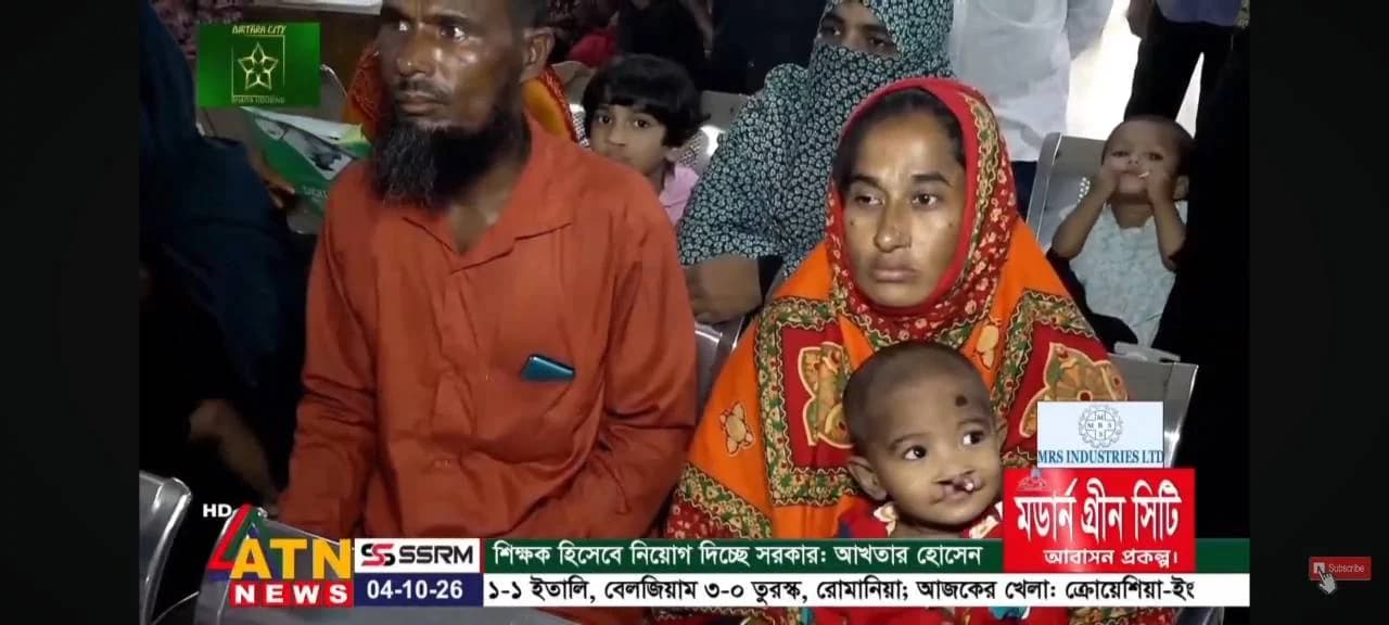 ATN News: Free surgery camp for cleft lip and palate